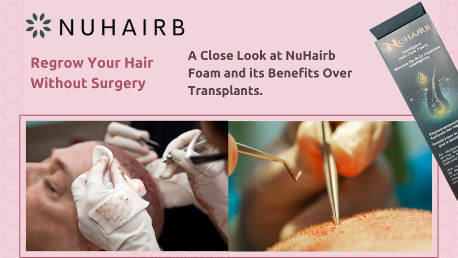 Regrow Your Hair Without Surgery: A Close Look at NuHairb Foam and its Benefits Over Transplants